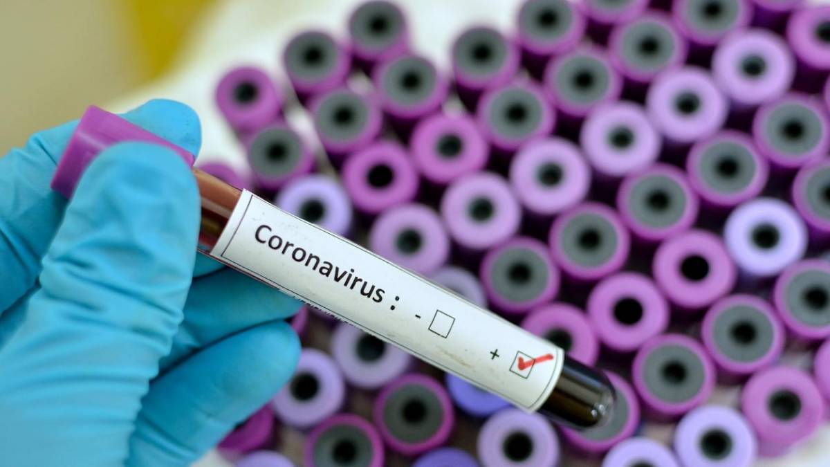 Teresina registra sete óbitos e 252 novos casos de Covid-19 em um dia
