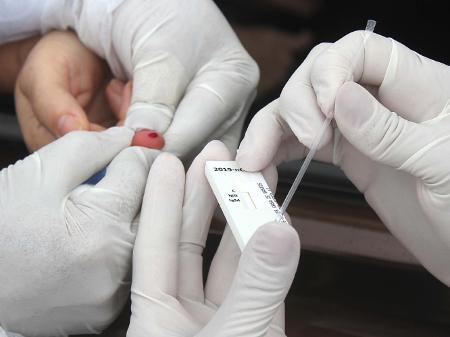 Brasil tem 713 óbitos e 28.523 novos casos de coronavírus em 24h